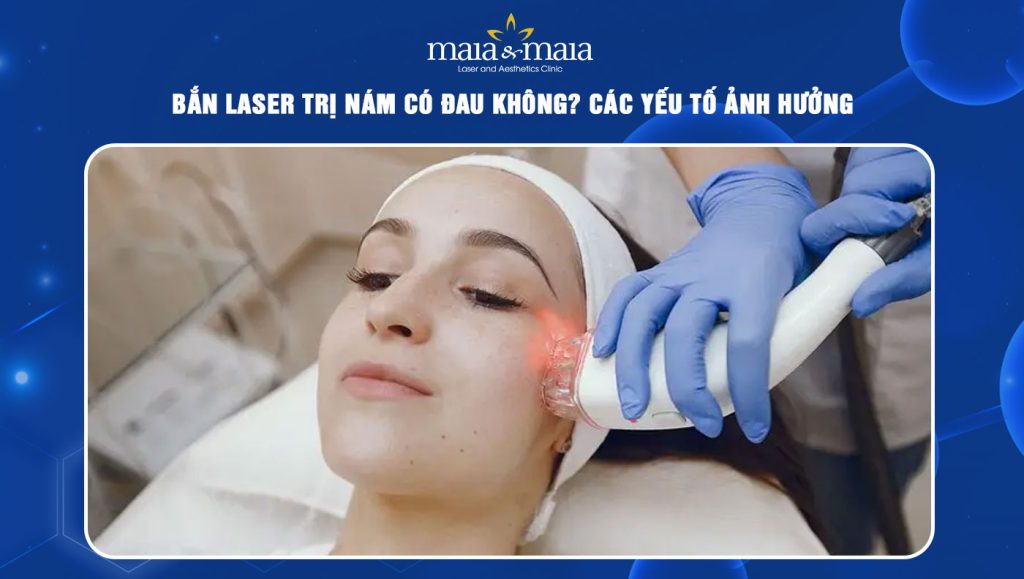bắn laser trị nám có đau không