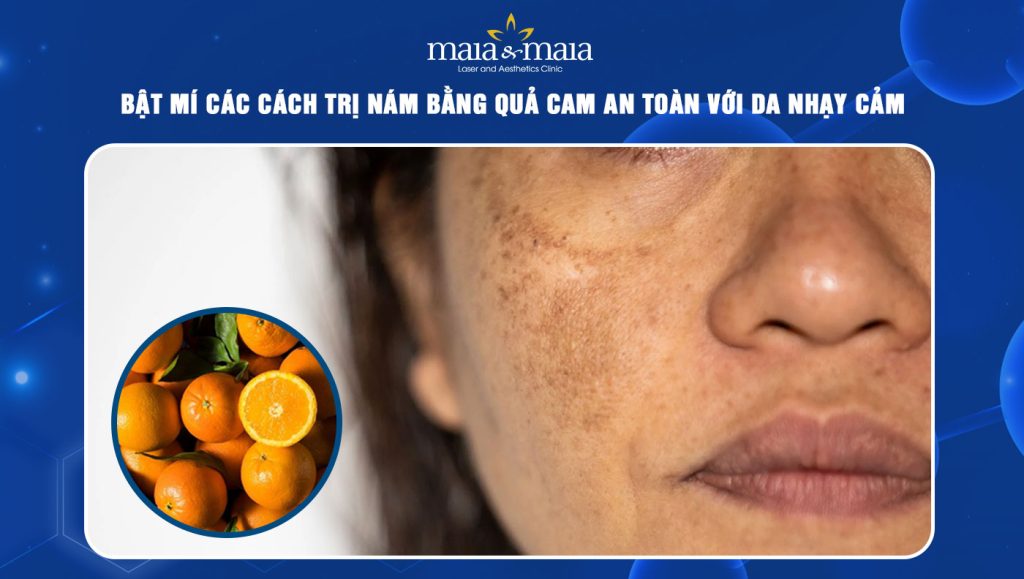 Bật mí các cách trị nám bằng quả cam an toàn với da nhạy cảm 1 cách trị nám bằng quả cam