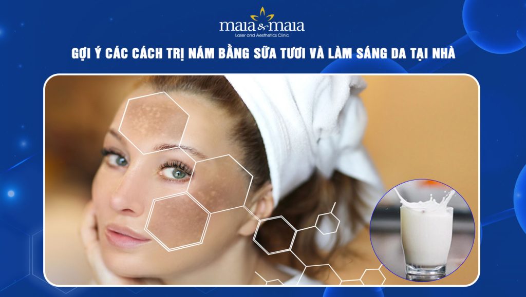cách trị nám bằng sữa tươi
