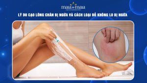cạo lông chân bị ngứa
