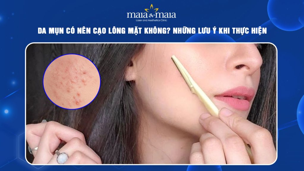da mụn có nên cạo lông mặt không