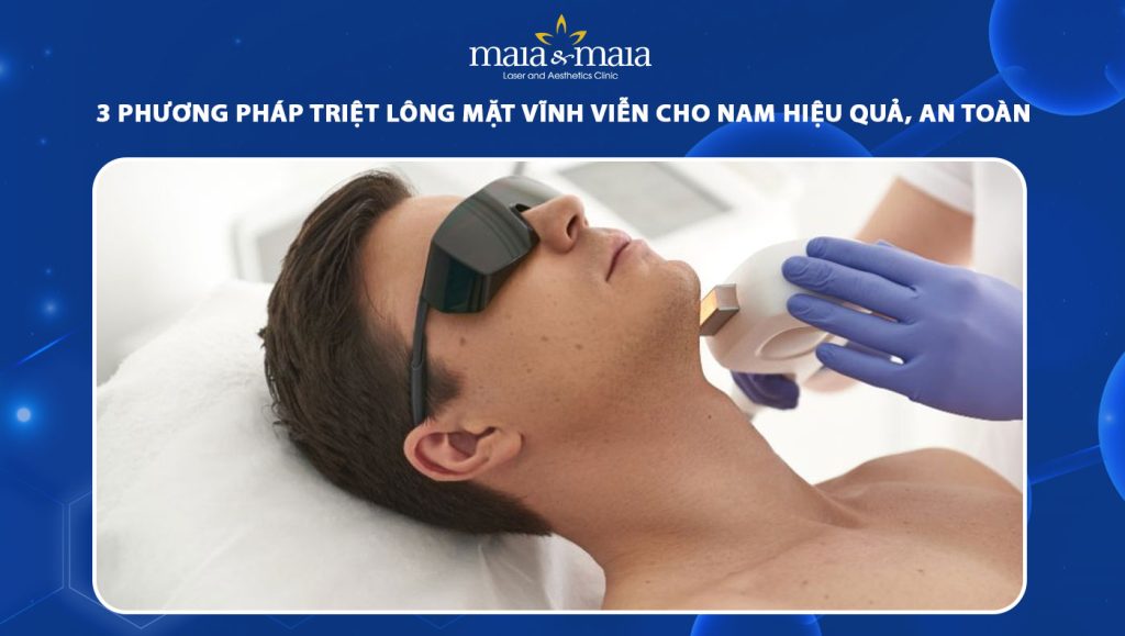 3 phương pháp triệt lông mặt vĩnh viễn cho nam hiệu quả, an toàn 1 triệt lông mặt vĩnh viễn cho nam