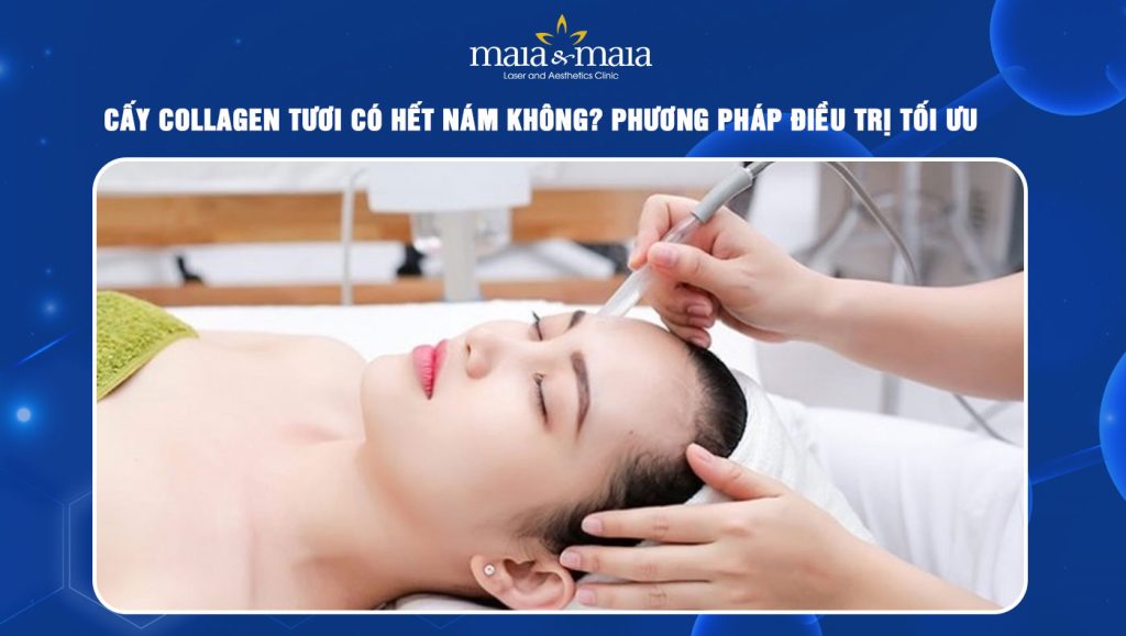 Cấy collagen tươi có hết nám không? Phương pháp điều trị tối ưu 1 cấy collagen tươi có hết nám không