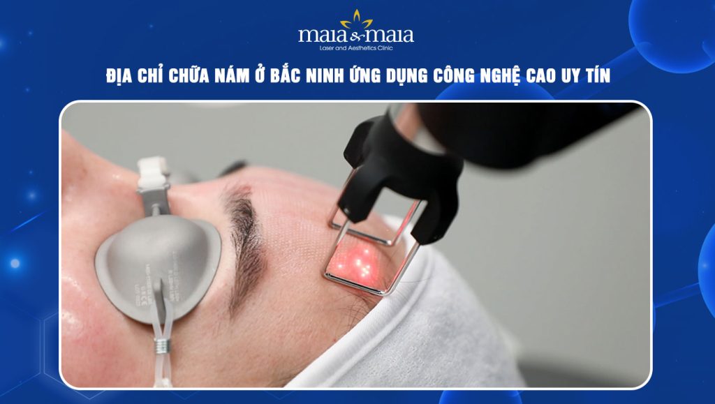 địa chỉ chữa nám ở Bắc Ninh
