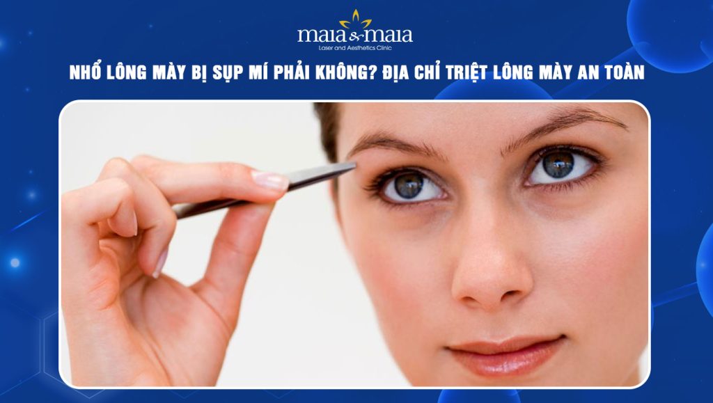 Nhổ lông mày bị sụp mí phải không? Địa chỉ triệt lông mày an toàn 1 nhổ lông mày bị sụp mí