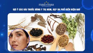 thuốc đông y trị nám