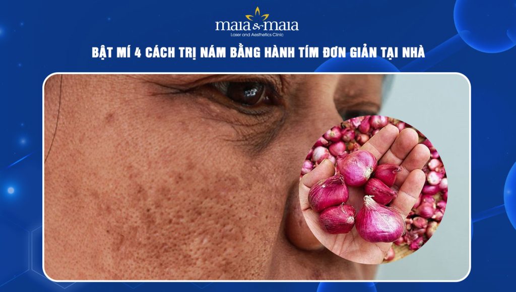 trí nám bằng hành tím