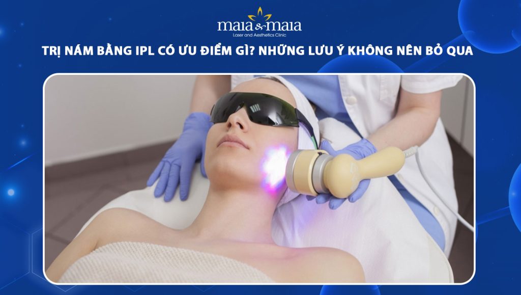 trị nám bằng ipl