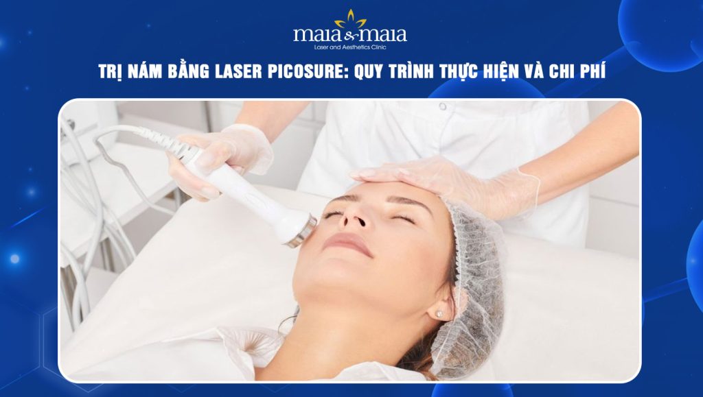 trị nám bằng laser picosure