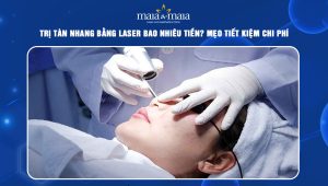 trị tàn nhang bằng laser bao nhiêu tiền
