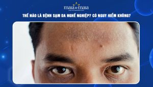 bệnh sạm da nghề nghiệp