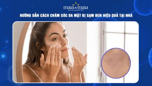 chăm sóc da mặt bị sạm đen