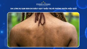 da lưng bị sạm đen