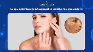 da sạm đen vào mùa đông