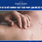 đồi mồi có tự hết không