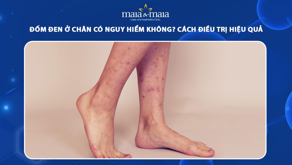 đốm đen ở chân