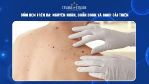 đốm đen trên da