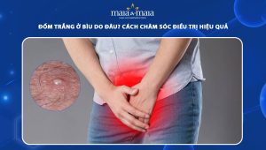 đốm trắng ở bìu