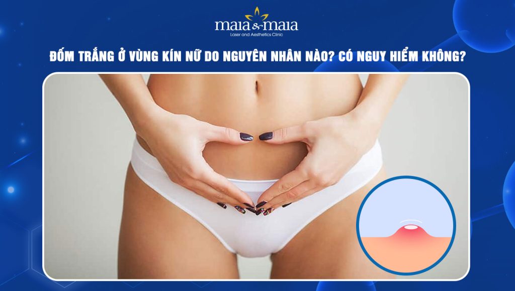 Đốm trắng ở vùng kín nữ do nguyên nhân nào? Có nguy hiểm không? 1 đốm trắng ở vùng kín nữ