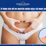 đốm trắng ở vùng kín nữ