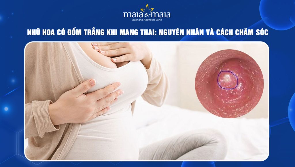 Nhũ hoa có đốm trắng khi mang thai: Nguyên nhân và cách chăm sóc 1 nhũ hoa có đốm trắng khi mang thai