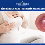 nhũ hoa có đốm trắng khi mang thai