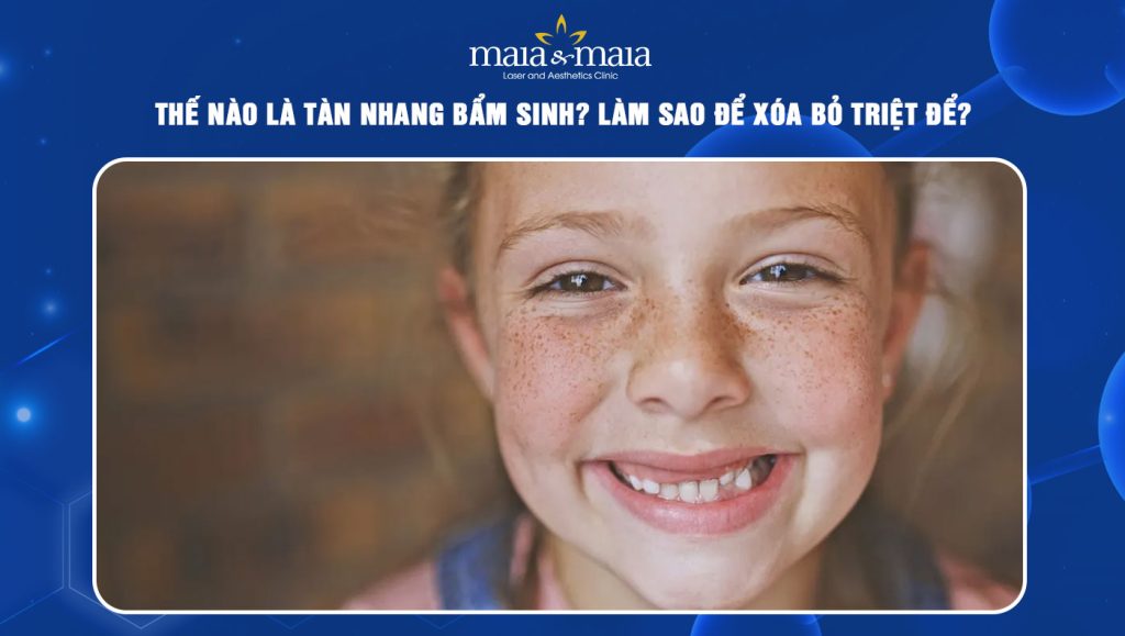 Thế nào là tàn nhang bẩm sinh? Làm sao để xóa bỏ triệt để? 1 tàn nhang bẩm sinh