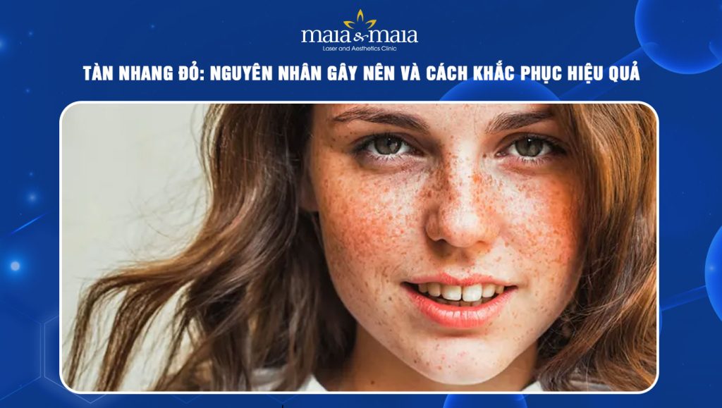 Tàn nhang đỏ: Nguyên nhân gây nên và cách khắc phục hiệu quả 1 tàn nhang đỏ