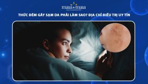 thức đêm gây sạm da