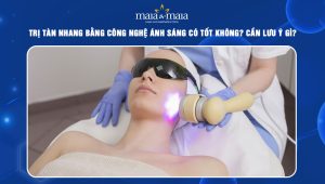 trị tàn nhang bằng công nghệ ánh sáng
