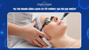 trị tàn nhang bằng laser