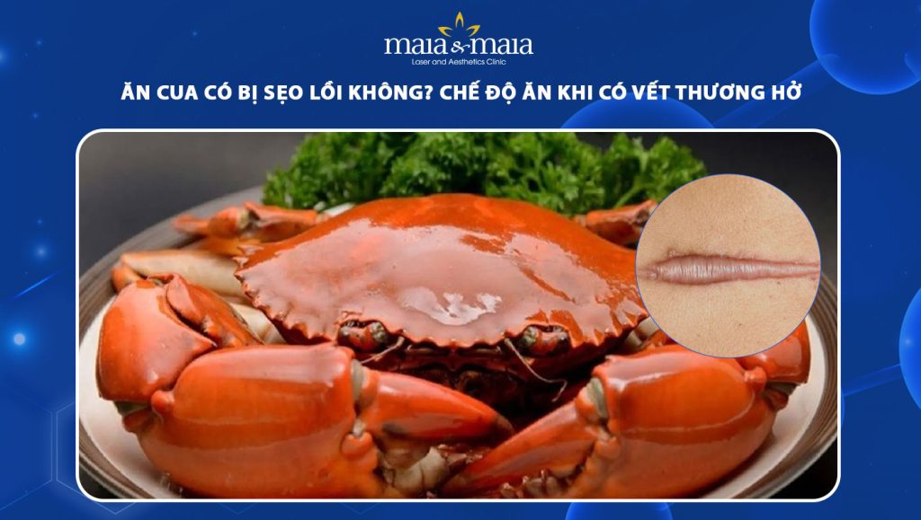 ăn cua có bị sẹo lồi không