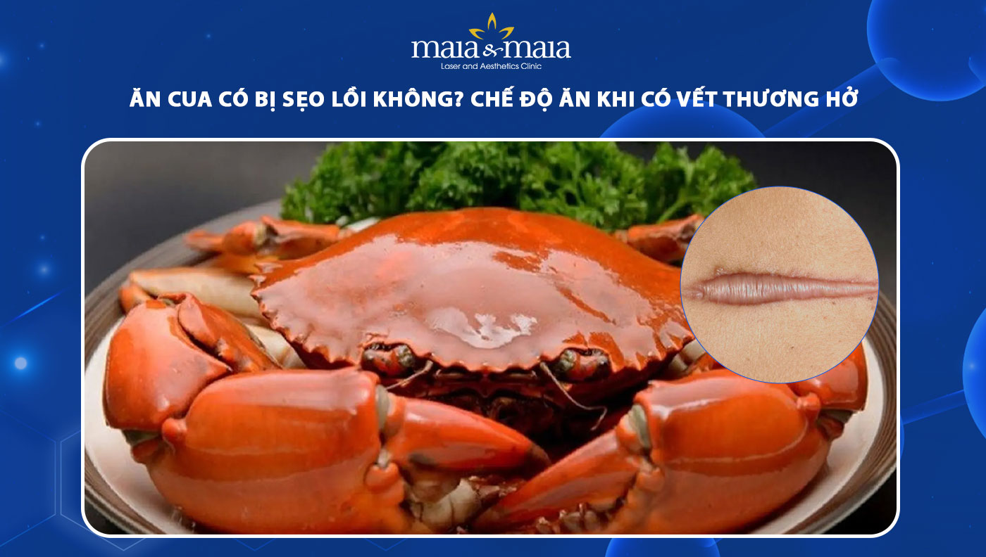 ăn cua có bị sẹo lồi không