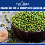 ăn đậu xanh có bị sẹo lồi không