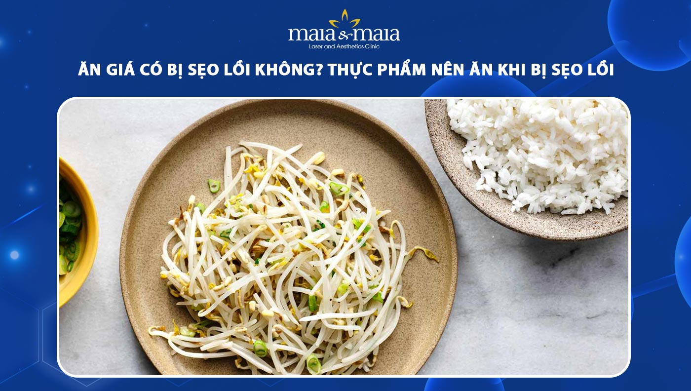 ăn giá có bị sẹo lồi không