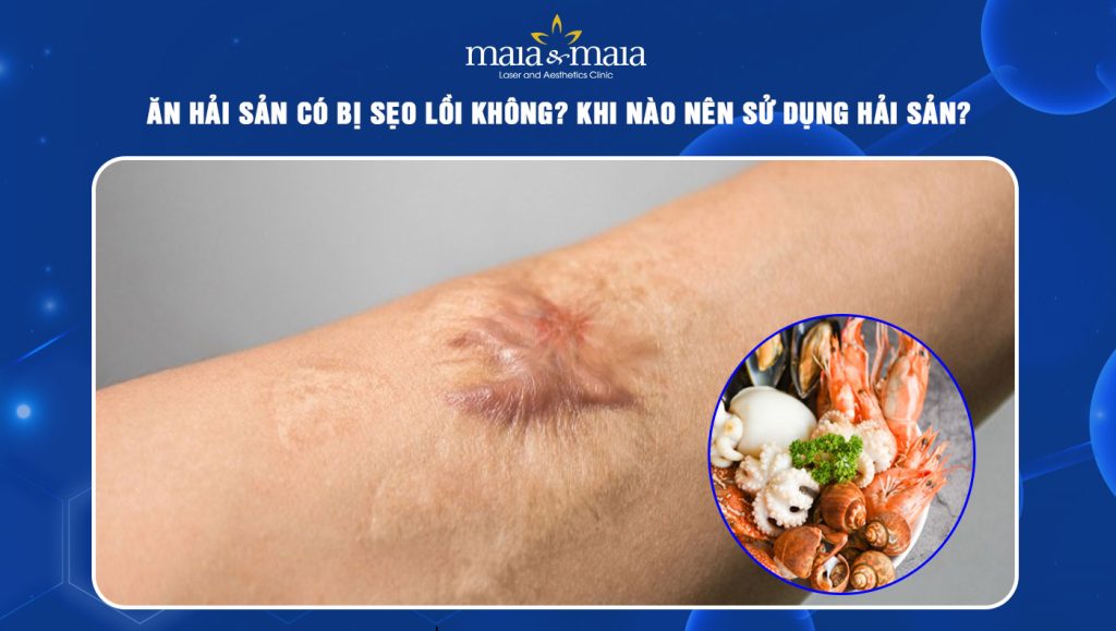 Ăn hải sản có bị sẹo lồi không? Khi nào nên sử dụng hải sản? 1 ăn hải sản có bị sẹo lồi không