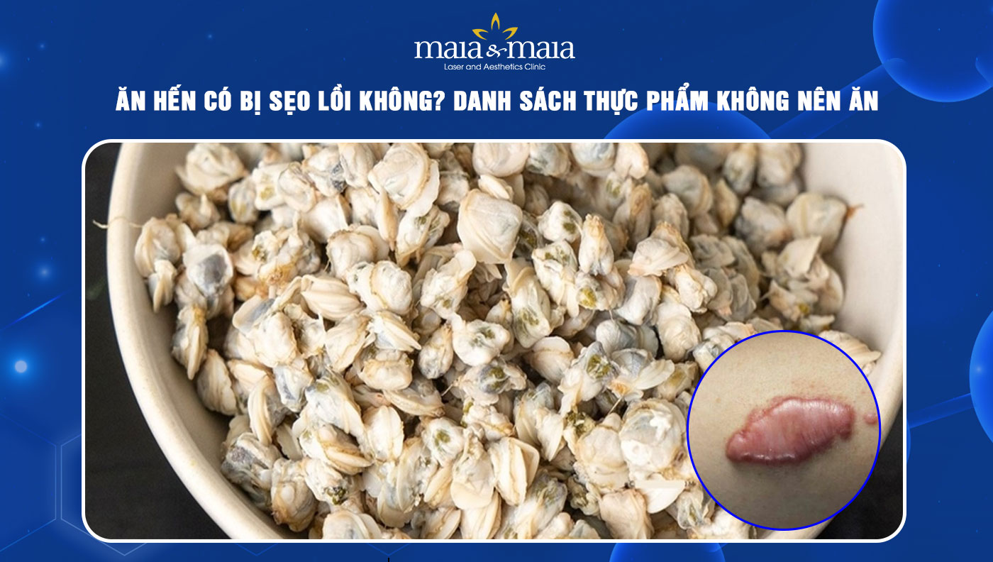 ăn hến có bị sẹo lồi không