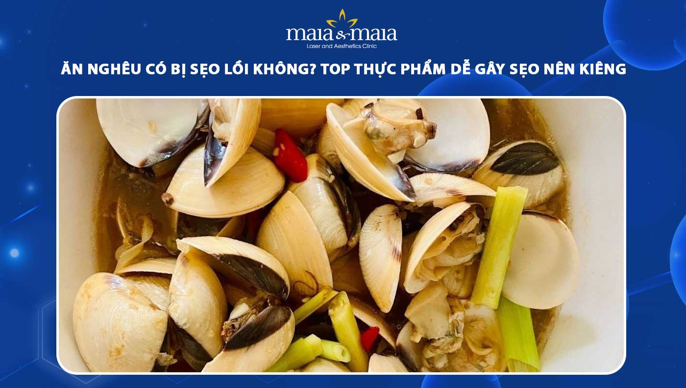 ăn nghêu có bị sẹo lồi không
