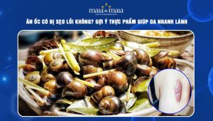 ăn ốc có bị sẹo lồi không