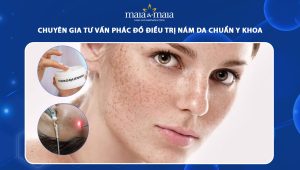 phác đồ điều trị nám