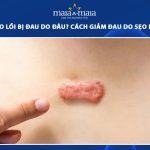 sẹo lồi bị đau
