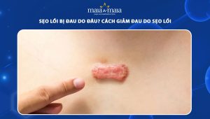sẹo lồi bị đau