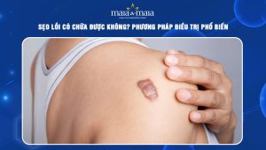 sẹo lồi có chữa được không
