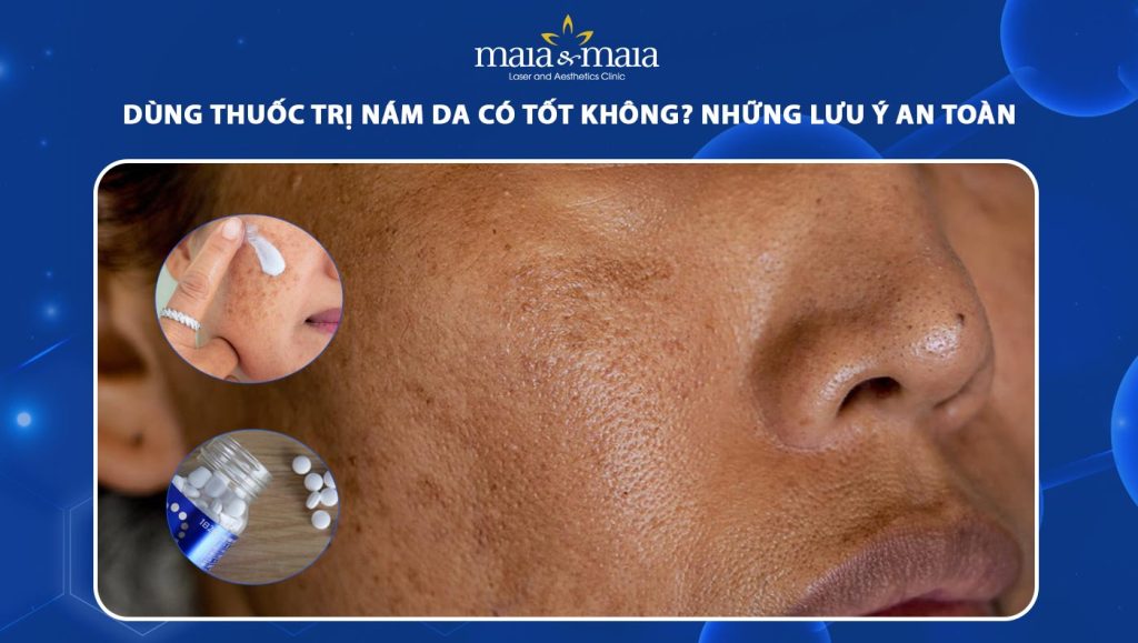 Dùng thuốc trị nám da có tốt không? Những lưu ý an toàn 1 thuốc trị nám da