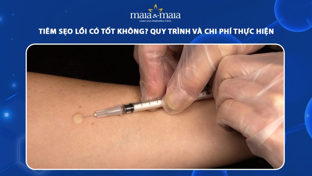 Tiêm sẹo lồi có tốt không? Quy trình và chi phí thực hiện 1 tiêm sẹo lồi