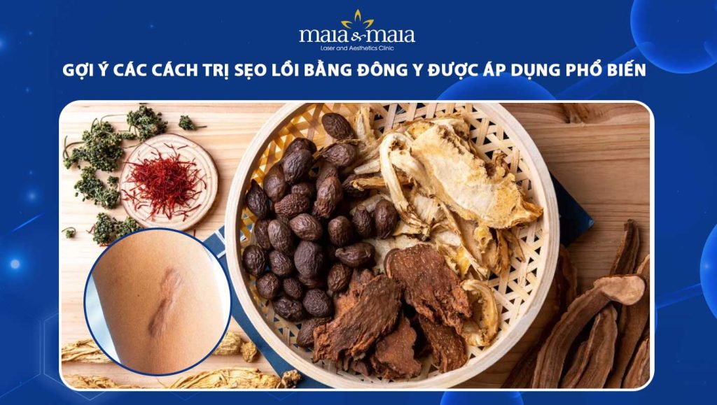 Gợi ý các cách trị sẹo lồi bằng Đông y được áp dụng phổ biến 1 trị sẹo lồi bằng đông y