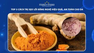 trị sẹo lồi bằng nghệ
