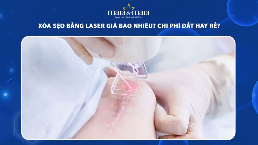 Xóa sẹo bằng laser giá bao nhiêu? Lưu ý khi laser trị sẹo 1 xóa sẹo bằng laser giá bao nhiêu