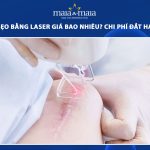 xóa sẹo bằng laser giá bao nhiêu