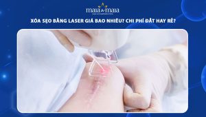 xóa sẹo bằng laser giá bao nhiêu